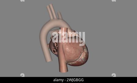 Anatomia cardiaca (esterna) superficie anteriore o sterenocostale: Principalmente l'illustrazione 3d del ventricolo destro Foto Stock