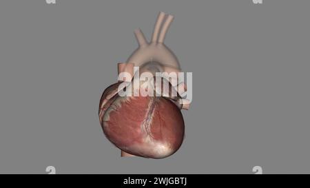 Anatomia cardiaca (esterna) superficie anteriore o sterenocostale: Principalmente l'illustrazione 3d del ventricolo destro Foto Stock