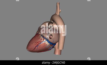 Anatomia cardiaca (esterna) superficie anteriore o sterenocostale: Principalmente l'illustrazione 3d del ventricolo destro Foto Stock