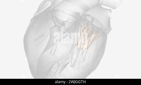 Corde mitraliche tendineasi 3D MED CAL Foto Stock