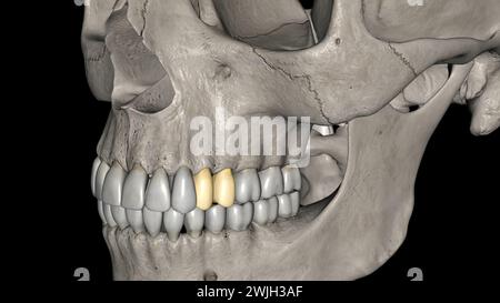 I premolari mascellari numero quattro: Due nella maxilla destra e due nella figura 3d della maxilla sinistra Foto Stock