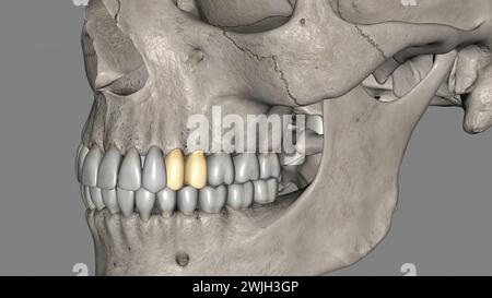 I premolari mascellari numero quattro: Due nella maxilla destra e due nella figura 3d della maxilla sinistra Foto Stock