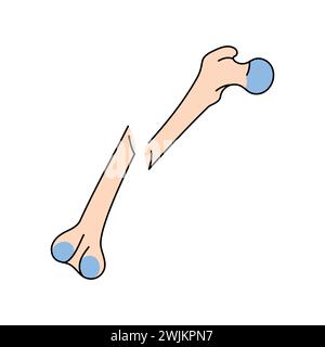 Icona della linea di frattura ossea obliqua spostata. Elemento isolato vettoriale. Traccia modificabile. Illustrazione Vettoriale