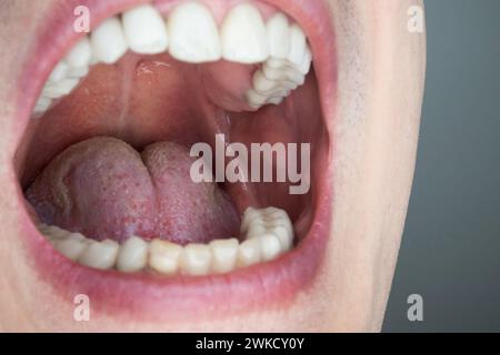 Maschio caucasico, cavità orale aperta, colpo ravvicinato. Foto Stock