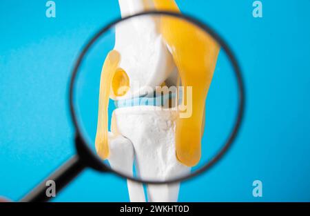 Mockup medico di un'articolazione del ginocchio su sfondo blu sotto una lente d'ingrandimento. Concetto di problemi alle articolazioni del ginocchio. Borsite, tendinite e gotta. Ortopedia Foto Stock