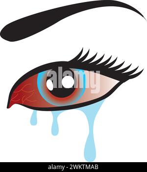 Influenza oculare infezione icona, occhi rossi malattia, arrossamento dell'occhio, congiuntivite. Illustrazione Vettoriale