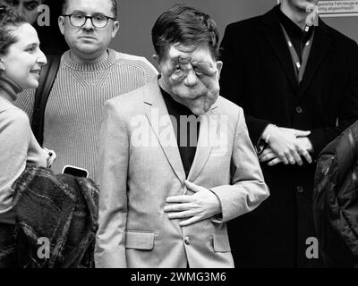 Berlino, Germania, 16 febbraio 2024. 74esima Berlinale, l'attore Adam Pearson lascia la conferenza stampa. Crediti: Walter Gilgen Foto Stock