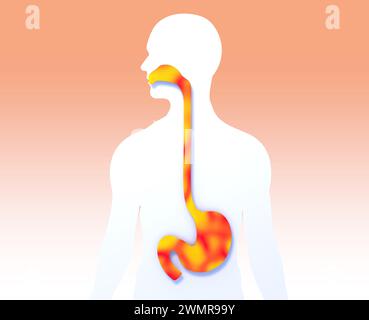 illustrazione 3d dello stomaco e dell'esofago in bocca con fuoco. Mostra il sistema digerente anatomico sulla sagoma umana ritagliata. Foto Stock