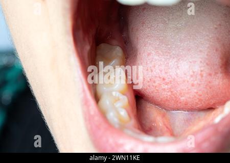 Una fotografia estremamente ravvicinata rivela dettagli intricati della bocca aperta di una persona, mostrando i denti e la consistenza della lingua Foto Stock