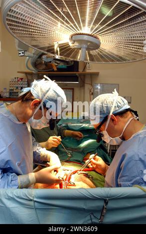 Il chirurgo Cirro Campanella, a sinistra, esegue un intervento chirurgico a cuore aperto presso l'Edinburgh Royal Infirmary, in Scozia. Foto Stock