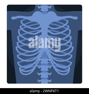 Scansione a raggi x medica del torace umano. Test di scheletro medico, radiografia del corpo illustrazione vettoriale del cartone animato Illustrazione Vettoriale