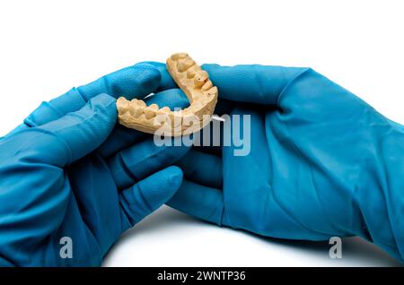 Dentista che tiene un getto di denti in guanti medici per fare protesi, primo piano, concetto dentale Foto Stock