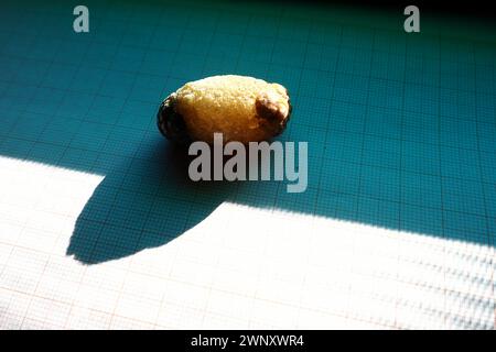 Malattia del calcoli biliari, colelitiasi - la formazione di pietre, calcoli nella cistifellea, dotti biliari. Calcoli biliari. Un grande gallone rimosso da a. Foto Stock