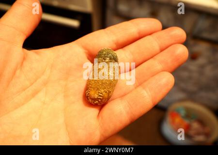 Malattia del calcoli biliari, colelitiasi - la formazione di pietre, calcoli nella cistifellea, dotti biliari. Calcoli biliari. Un grande gallone rimosso da a. Foto Stock