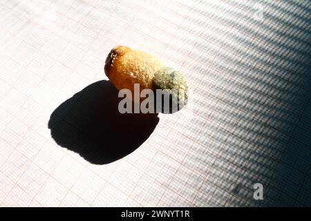 Malattia del calcoli biliari, colelitiasi - la formazione di pietre, calcoli nella cistifellea, dotti biliari. Calcoli biliari. Un grande gallone rimosso da a. Foto Stock