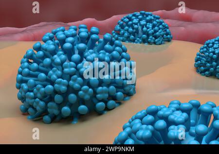 Virus dell'influenza (influenza) e muco nel polmone - Vista ravvicinata illustrazione 3d. Foto Stock