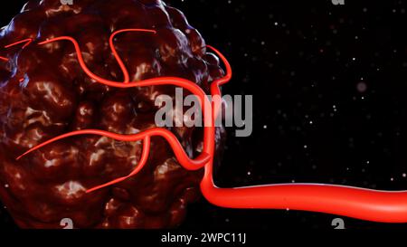 il rendering 3d del cancro richiede un apporto di sangue per fornire i nutrienti e l'ossigeno necessari per crescere e sopravvivere Foto Stock