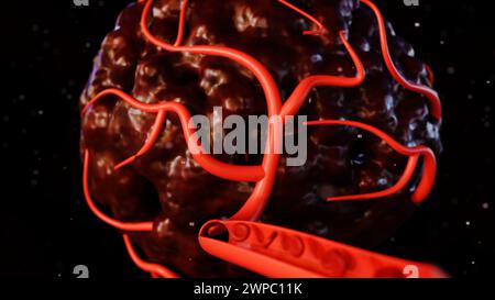 il rendering 3d del cancro richiede un apporto di sangue per fornire i nutrienti e l'ossigeno necessari per crescere e sopravvivere Foto Stock