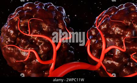 il rendering 3d del cancro richiede un apporto di sangue per fornire i nutrienti e l'ossigeno necessari per crescere e sopravvivere Foto Stock