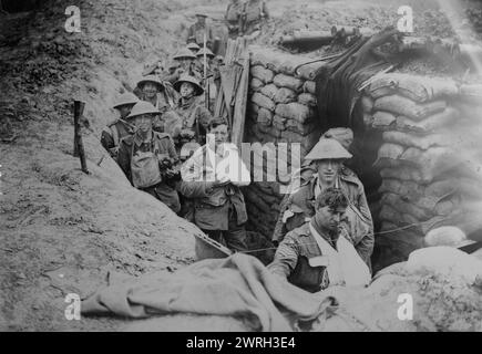 Ferito britannico in trincea, 18 agosto 1918. Soldati britannici feriti della 27th Brigade, 9th Division, in una trincea in un posto di aiuto reggimentale vicino a Outtersteene Ridge dopo il successo dell'attacco della formazione a Outtersteene Ridge, Fiandre, Belgio, 18 agosto 1918 durante la prima guerra mondiale Foto Stock