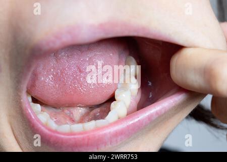 Vista ravvicinata dettagliata all'interno di una bocca, che mostra denti e lingua sani Foto Stock
