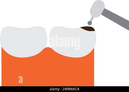 Concetto di cavità dentale.. Denti sani sorridenti con cartoni animati tristi di decadimento in design piatto Illustrazione Vettoriale