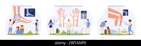Diagnosi e trattamento di osteoartrite, artrite reumatoide, set reumatologico. Le persone di piccole dimensioni con lente d'ingrandimento studiano i raggi X delle articolazioni del piede, del ginocchio e del polso dell'illustrazione vettoriale dei cartoni animati del paziente Illustrazione Vettoriale