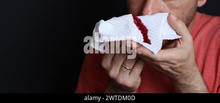 Uomo che tiene in mano un fazzoletto sanguinoso, primo piano Foto Stock