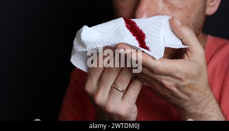 Uomo che tiene in mano un fazzoletto sanguinoso, primo piano Foto Stock