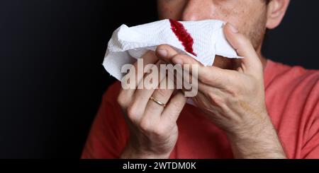 Uomo che tiene in mano un fazzoletto sanguinoso, primo piano Foto Stock