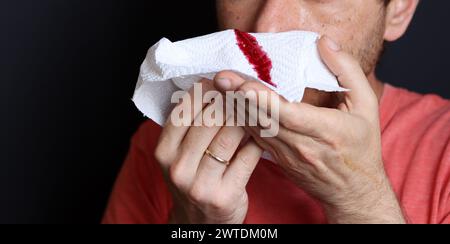 Uomo che tiene in mano un fazzoletto sanguinoso, primo piano Foto Stock