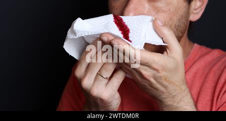 Uomo che tiene in mano un fazzoletto sanguinoso, primo piano Foto Stock