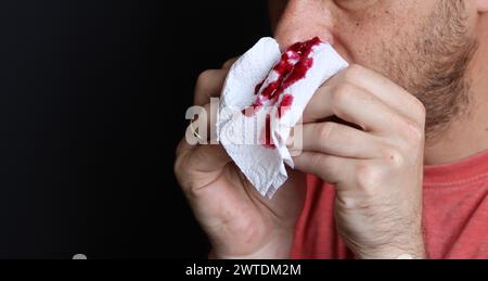 Uomo che tiene in mano un fazzoletto sanguinoso, primo piano Foto Stock