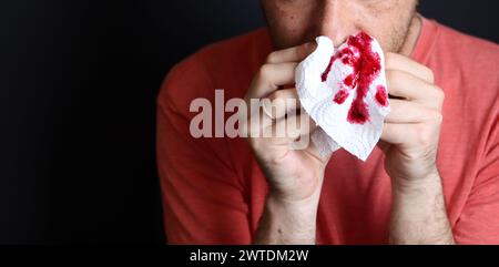 Uomo che tiene in mano un fazzoletto sanguinoso, primo piano Foto Stock