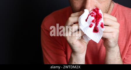 Uomo che tiene in mano un fazzoletto sanguinoso, primo piano Foto Stock