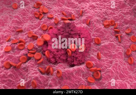 Globuli rossi e coagulo della fibrina - Vista isometrica illustrazione 3d. Foto Stock