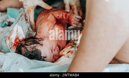 Immagine di nascita autentica: Una bambina appena nata piangente con i capelli scuri coperti di sangue pochi istanti dopo la nascita. Cordone ombelicale ancora attaccato. Foto Stock