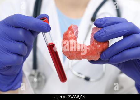 Endocrinologo che mostra il modello della ghiandola tiroidea e il campione di sangue nella provetta di analisi, primo piano Foto Stock