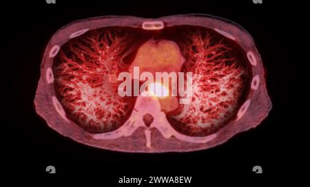 Immagine di rendering TC toracica o polmonare 3d che mostra trachea e polmoni nel sistema respiratorio. Foto Stock