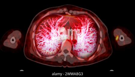 Immagine di rendering TC toracica o polmonare 3d che mostra trachea e polmoni nel sistema respiratorio. Foto Stock