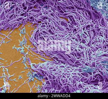 Batteri fecali. Micrografia elettronica a scansione (SEM) di batteri coltivati da un campione di feci umane. Almeno il 50 per cento delle feci umane è costituito da batteri fuoriusciti dall'intestino. Molti di questi batteri sono una parte normale della flora presente nell'intestino e sono utili per la digestione. Tuttavia, alcuni sono patogeni, come la Salmonella enterica e alcuni ceppi di Escherichia coli, che possono causare malattie trasmesse dagli alimenti. Ingrandimento: X1500 se stampato largo 10 centimetri. Foto Stock