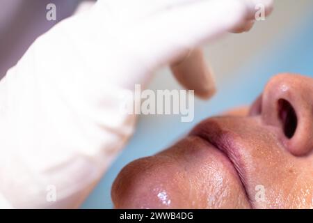 Peeling della faccia. Nell'ufficio di un dermatologo parigino. Foto Stock