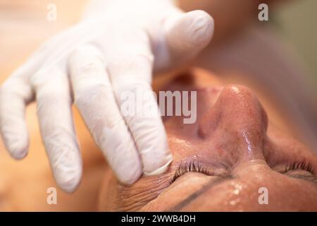 Peeling della faccia. Nell'ufficio di un dermatologo parigino. Foto Stock