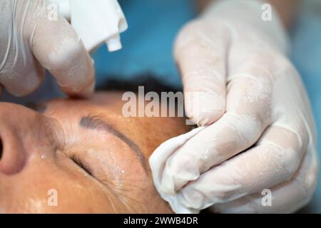 Peeling della faccia. Nell'ufficio di un dermatologo parigino. Foto Stock