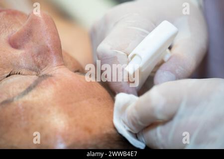 Peeling della faccia. Nell'ufficio di un dermatologo parigino. Foto Stock