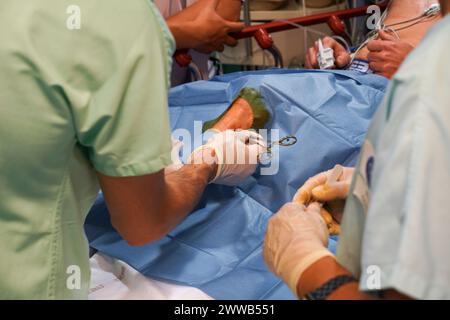 Paziente nel reparto shock dell'unità di terapia intensiva di un ospedale universitario. Foto Stock