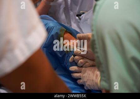 Paziente nel reparto shock dell'unità di terapia intensiva di un ospedale universitario. Foto Stock