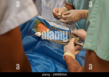 Paziente nel reparto shock dell'unità di terapia intensiva di un ospedale universitario. Foto Stock