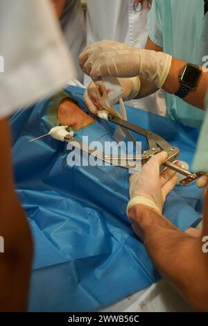 Paziente nel reparto shock dell'unità di terapia intensiva di un ospedale universitario. Foto Stock