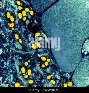 Micrografia elettronica a trasmissione colorata di particelle di vaiolo monkeyico (gialla) trovate all'interno di una cellula infetta (blu), coltivate in laboratorio. Foto Stock